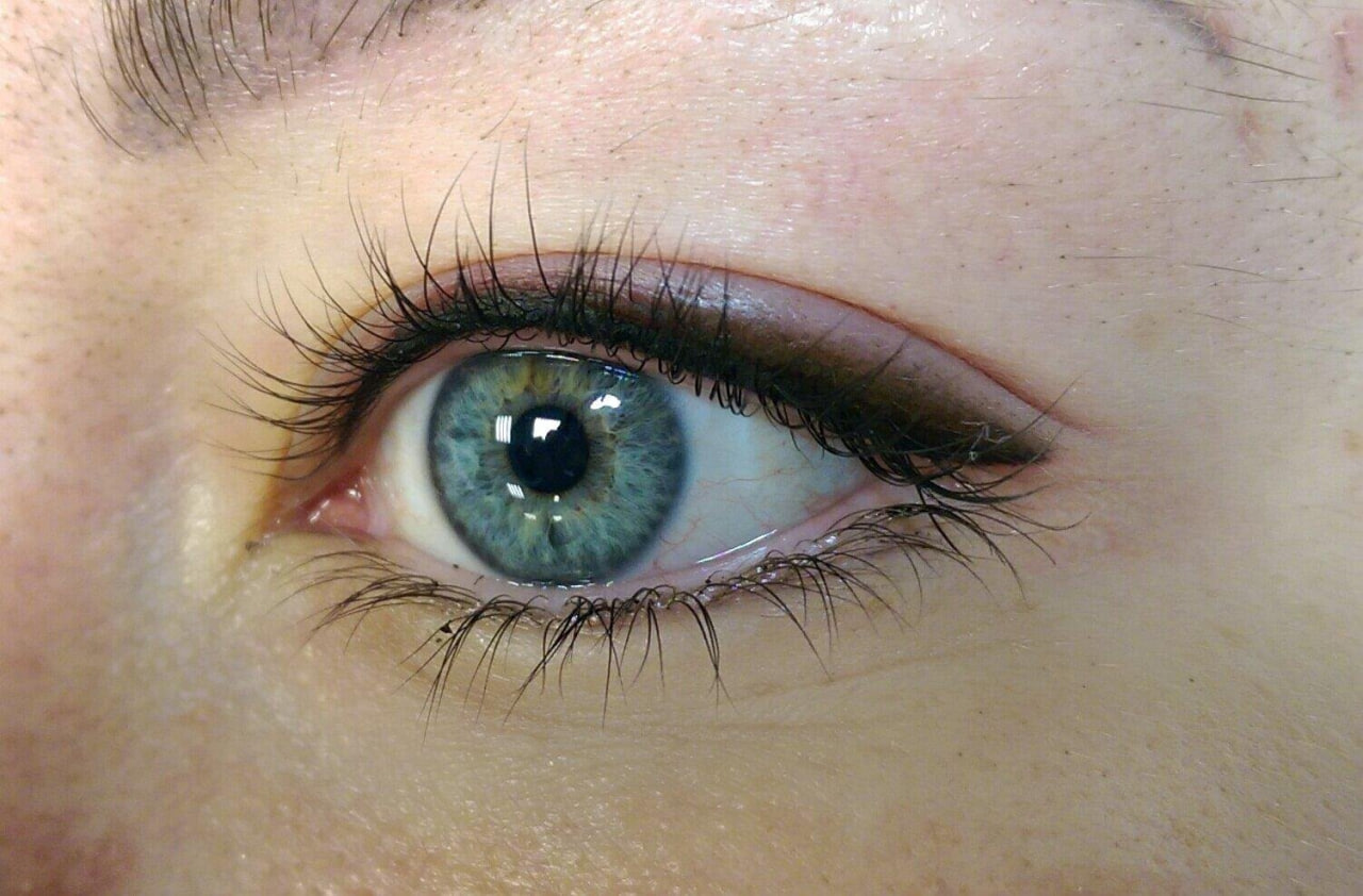 Веки: межресничка